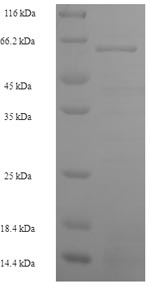 Greater than 90% as determined by SDS-PAGE.Recombinant Human S-Phase Kinase-Associated Protein 2 (SKP2) Protein (His-SUMO)