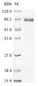 Greater than 85% as determined by SDS-PAGE.Recombinant Human Calcium/Calmodulin-Dependent Protein Kinase Type Ii Subunit Delta (CAMK2D) Protein (His)