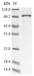 Greater than 85% as determined by SDS-PAGE.Recombinant Human Calcium/Calmodulin-Dependent Protein Kinase Type Ii Subunit Delta (CAMK2D) Protein (His)