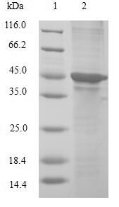 Greater than 90% as determined by SDS-PAGE.Recombinant Human Cold-Inducible Rna-Binding Protein (CIRBP) Protein (GST)