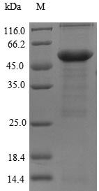 Greater than 90% as determined by SDS-PAGE.Recombinant Human Myosin-Binding Protein C, Cardiac-Type (MYBPC3) Protein (His-SUMO)