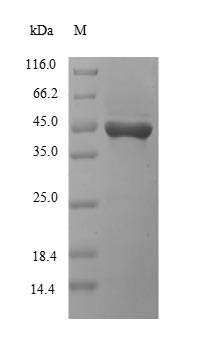 Greater than 85% as determined by SDS-PAGE.Recombinant Human Killer Cell Immunoglobulin-Like Receptor 2Ds3 (KIR2DS3) Protein (His-SUMO&Myc)