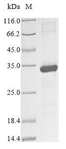 Greater than 85% as determined by SDS-PAGE.Recombinant Human Killer Cell Immunoglobulin-Like Receptor 2Ds3 (KIR2DS3) Protein (His&Myc)