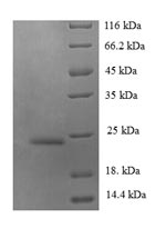 Greater than 90% as determined by SDS-PAGE.