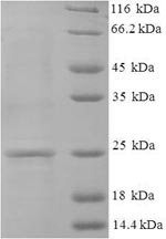 Greater than 90% as determined by SDS-PAGE.Recombinant Human Guanylate Cyclase Activator 2B (GUCA2B) Protein (His-SUMO)