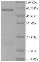 Greater than 90% as determined by SDS-PAGE.Recombinant Human Kynurenine--Oxoglutarate Transaminase 1 (KYAT1) Protein (His-SUMO)