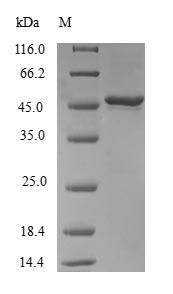 Greater than 90% as determined by SDS-PAGE.Recombinant Human Ras-Related Protein Rab-31 (RAB31) Protein (GST)