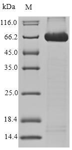Greater than 90% as determined by SDS-PAGE.Recombinant Human Cd166 Antigen (ALCAM) Protein (His-SUMO)