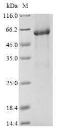 Greater than 85% as determined by SDS-PAGE.Recombinant Human Bifunctional 3'-5' Exonuclease/Atp-Dependent Helicase Wrn (WRN) Protein (His)