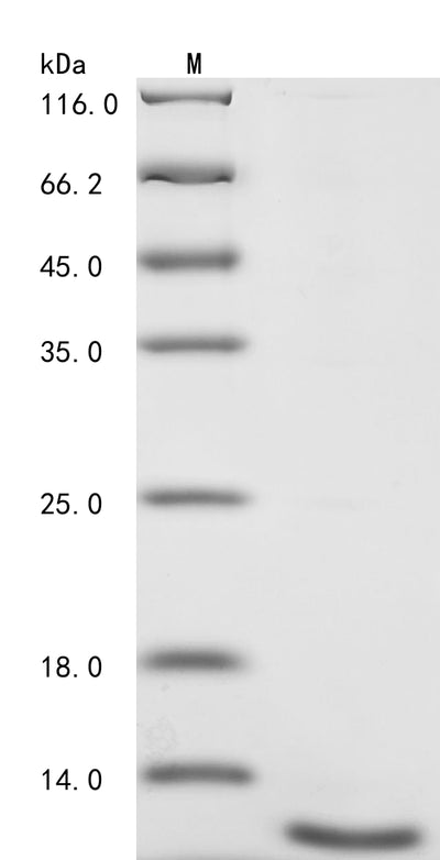Greater than 90% as determined by SDS-PAGE.Recombinant Human Inorganic Pyrophosphatase (PPA1) Protein (His)