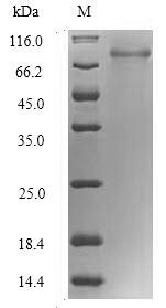 Greater than 90% as determined by SDS-PAGE.Recombinant Human Rna-Binding Motif Protein, Y Chromosome, Family 1 Member F/J (RBMY1F) Protein (His-SUMO)