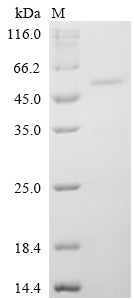 Greater than 90% as determined by SDS-PAGE.Recombinant Human Neuronal Pentraxin-1 (NPTX1) Protein (His-GST&Myc)