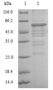Greater than 90% as determined by SDS-PAGE.Recombinant Human Dehydrogenase/Reductase Sdr Family Member 2, Mitochondrial (DHRS2) Protein (GST)