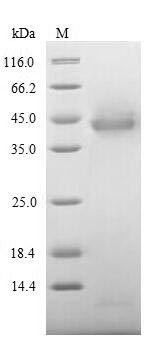Greater than 85% as determined by SDS-PAGE.Recombinant Human Inter-Alpha-Trypsin Inhibitor Heavy Chain H4 (ITIH4) Protein (His-SUMO)