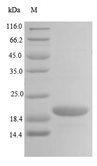 Greater than 85% as determined by SDS-PAGE.Recombinant Human E3 Ubiquitin-Protein Ligase Trip12 (TRIP12) Protein (His&Myc)