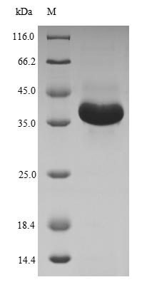 Greater than 90% as determined by SDS-PAGE.Recombinant Human Membrane-Bound Transcription Factor Site-1 Protease (MBTPS1) Protein (His-SUMO)