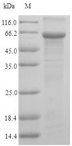 Greater than 90% as determined by SDS-PAGE.Recombinant Human Udp-N-Acetylhexosamine Pyrophosphorylase (UAP1) Protein (His)