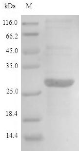 Greater than 90% as determined by SDS-PAGE.Recombinant Human Aminoacyl Trna Synthase Complex-Interacting Multifunctional Protein 2 (AIMP2) Protein (His)