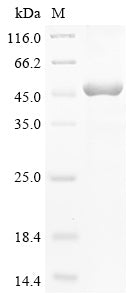 Greater than 85% as determined by SDS-PAGE.Recombinant Human N-Myc-Interactor (NMI) Protein (His-GST&Myc)