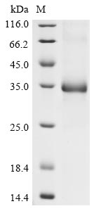 Greater than 90% as determined by SDS-PAGE.Recombinant Human Coronavirus Hku1 Spike Glycoprotein (S) Protein (His)
