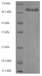 Greater than 90% as determined by SDS-PAGE.Recombinant Human Electron Transfer Flavoprotein-Ubiquinone Oxidoreductase, Mitochondrial (ETFDH) Protein (His-SUMO)