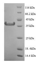 Greater than 90% as determined by SDS-PAGE.Recombinant Human Mitotic Spindle Assembly Checkpoint Protein Mad2A (MAD2L1) Protein (His-SUMO)