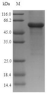 Greater than 90% as determined by SDS-PAGE.Recombinant Human Acid Ceramidase (ASAH1) Protein (His-SUMO)