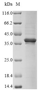 Greater than 85% as determined by SDS-PAGE.Recombinant Human Four And A Half Lim Domains Protein 1 (FHL1) Protein (His)