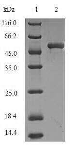 Greater than 90% as determined by SDS-PAGE.Recombinant Human Dynactin Subunit 1 (DCTN1) Protein (His-SUMO)