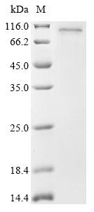 Greater than 85% as determined by SDS-PAGE.Recombinant Human Tnfaip3-Interacting Protein 1 (TNIP1) Protein (His)