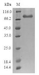 Greater than 90% as determined by SDS-PAGE.Recombinant Human Histone-Lysine N-Methyltransferase Setdb1 (SETDB1) Protein (GST)