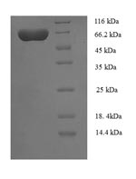 Greater than 90% as determined by SDS-PAGE.Recombinant Human Utp--Glucose-1-Phosphate Uridylyltransferase (UGP2) Protein (His-SUMO)
