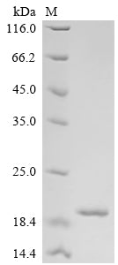 Greater than 90% as determined by SDS-PAGE.Recombinant Human Lymphocyte Antigen 6K (LY6K) Protein (His&Myc)