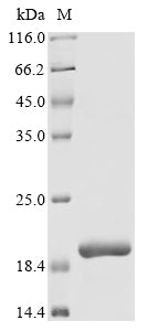 Greater than 90% as determined by SDS-PAGE.Recombinant Human Ap-3 Complex Subunit Beta-2 (AP3B2) Protein (His&Myc)