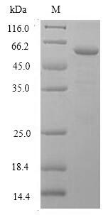 Greater than 90% as determined by SDS-PAGE.Recombinant Human Deoxyribonuclease Gamma (DNASE1L3) Protein (GST)