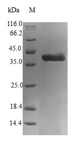 Greater than 90% as determined by SDS-PAGE.Recombinant Human Astrocytic Phosphoprotein Pea-15 (PEA15) Protein (GST)