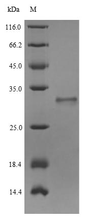 Greater than 90% as determined by SDS-PAGE.Recombinant Human Unconventional Myosin-Viia (MYO7A) Protein (His-SUMO)
