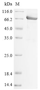 Greater than 85% as determined by SDS-PAGE.Recombinant Human Desmoglein-2 (DSG2) Protein (His)