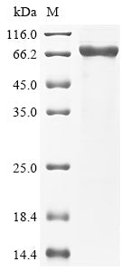 Greater than 85% as determined by SDS-PAGE.Recombinant Human Desmoglein-2 (DSG2) Protein (His)