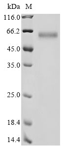 Greater than 90% as determined by SDS-PAGE.Recombinant Human Dihydropyrimidinase-Related Protein 3 (DPYSL3) Protein (His)