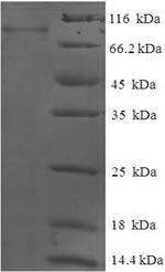 Greater than 90% as determined by SDS-PAGE.Recombinant Human Glucokinase Regulatory Protein (GCKR) Protein (His-SUMO)