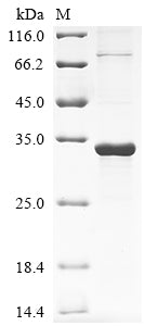 Greater than 85% as determined by SDS-PAGE.Recombinant Human Protein Rrp5 Homolog (PDCD11) Protein (His&Myc)