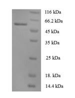 Greater than 90% as determined by SDS-PAGE.Recombinant Human Angiopoietin-1 (ANGPT1) Protein (His)