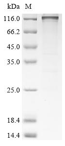 Greater than 85% as determined by SDS-PAGE.Recombinant Human Disks Large-Associated Protein 5 (DLGAP5) Protein (GST)
