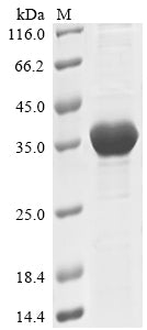 Greater than 85% as determined by SDS-PAGE.Recombinant Human Serine/Threonine-Protein Kinase N1 (PKN1) Protein (His)