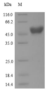 Greater than 85% as determined by SDS-PAGE.Recombinant Human Serotonin N-Acetyltransferase (AANAT) Protein (His-GST)