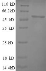 Greater than 90% as determined by SDS-PAGE.Recombinant Human Hyaluronidase-1 (HYAL1) Protein (His)