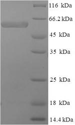Greater than 90% as determined by SDS-PAGE.Recombinant Human Swi/Snf-Related Matrix-Associated Actin-Dependent Regulator Of Chromatin Subfamily B Member 1 (SMARCB1) Protein (His-SUMO)