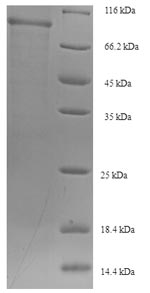 Greater than 90% as determined by SDS-PAGE.Recombinant Human Sorting Nexin-1 (SNX1) Protein (His-SUMO)