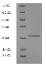 Greater than 90% as determined by SDS-PAGE.Recombinant Human Killer Cell Immunoglobulin-Like Receptor 2Ds1 (KIR2DS1) Protein (His)